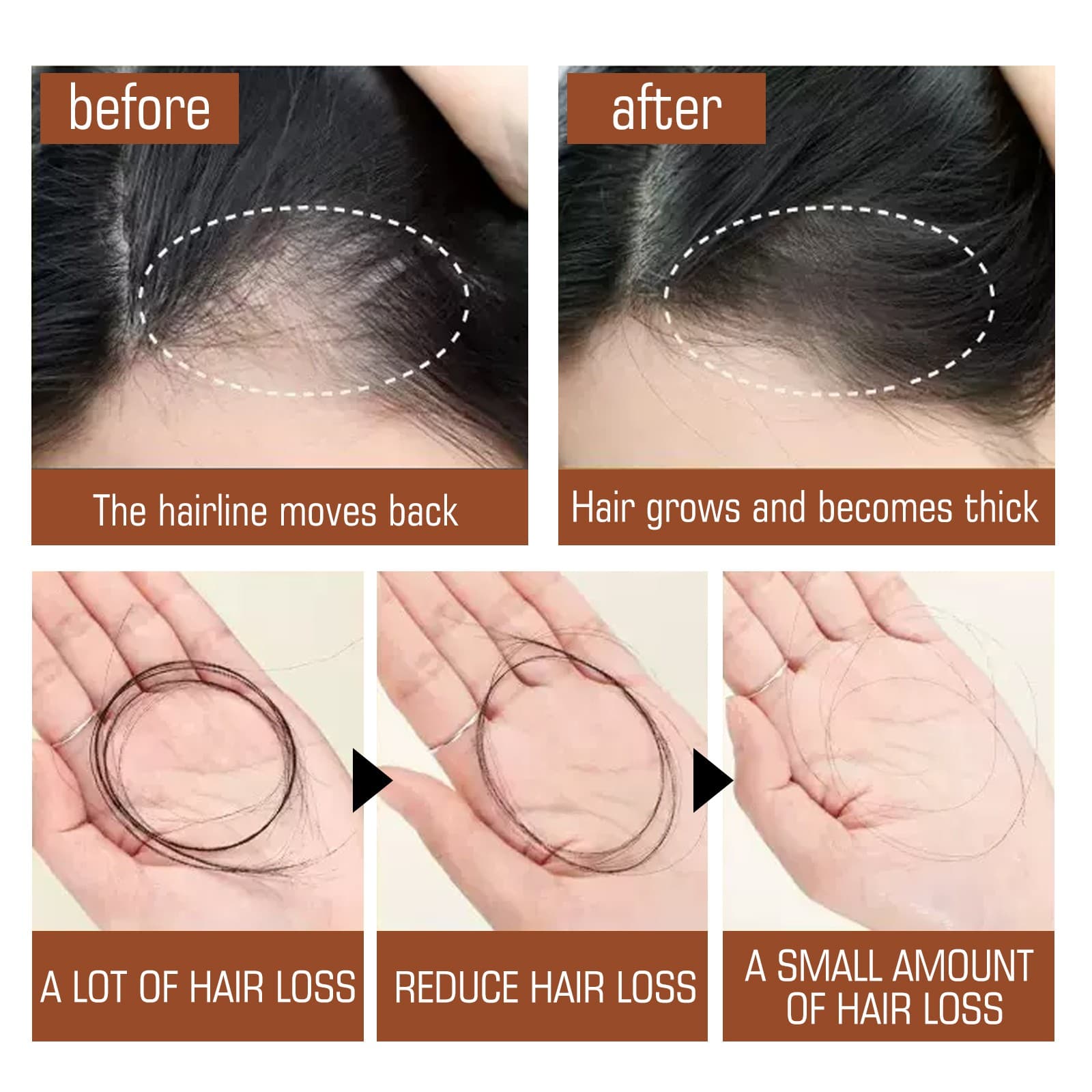 Batana Oil Hair Conditioner, Natural Batana Oil For Hair Growth For Healthier Thicker Hair, Stimulates Hair Follicles